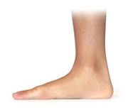 flat feet Sodwalls, 2790
