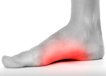 Arch Pain - Blue Mountains Podiatry